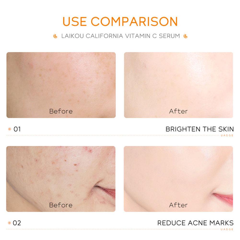 Tinh Chất Vitamin C 1.5ml Dưỡng Ẩm Chăm Sóc Da Mặt F5K0