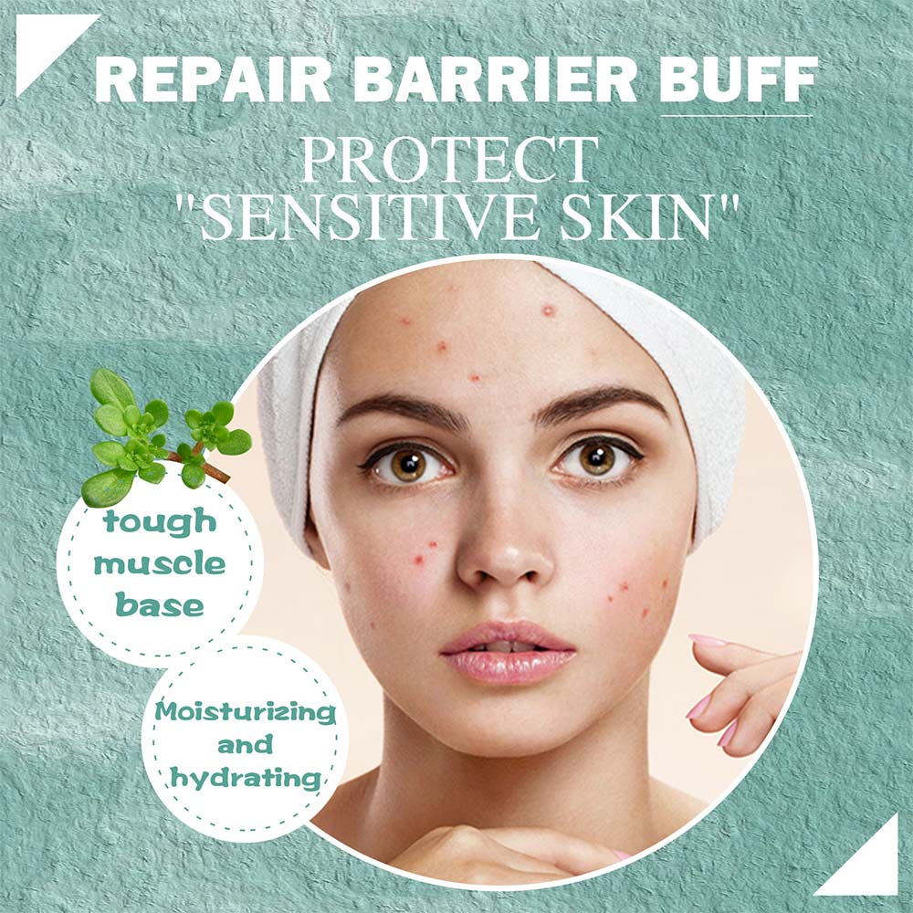 2pcs/100ml jaysuing salicylic acid cystic acne cream facial repair cream