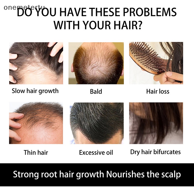 Con Lăn Massage Kích Thích Mọc Tóc Và Râu Chống Rụng Tóc Hiệu Quả