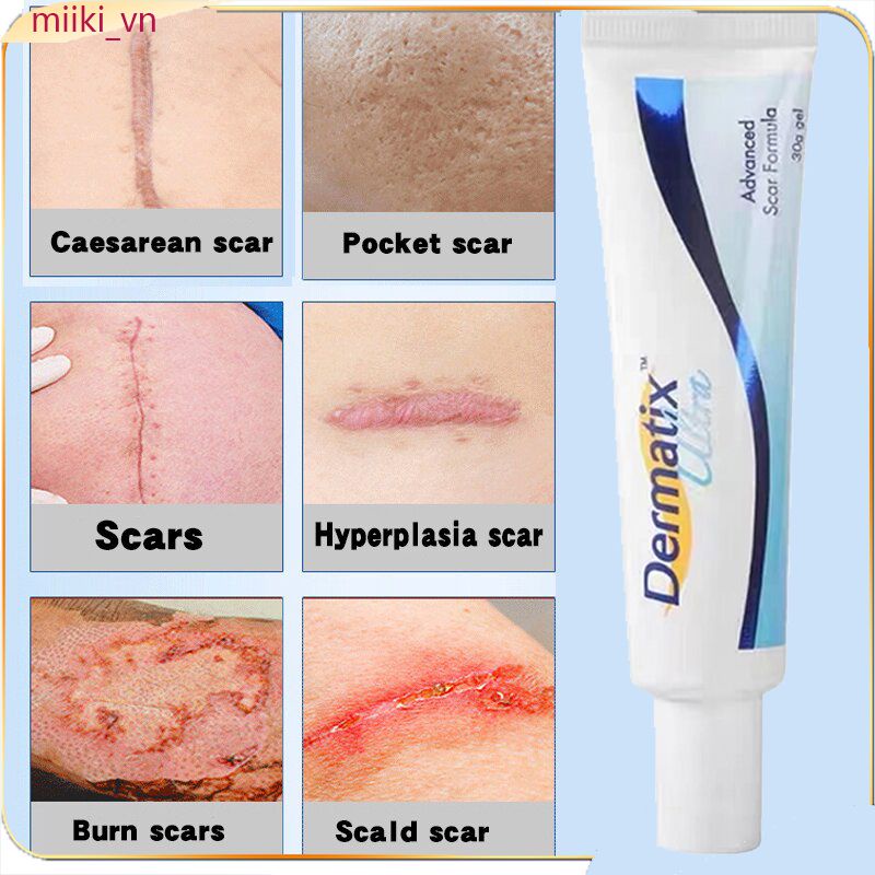 Kem Hỗ trợ giảm sẹo Dermatix 7Days Làm Mờ Sẹo / Vết Bỏng / Vết Rạn Da Hiệu Quả