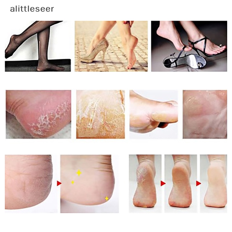 Dụng Cụ Cạo Da Chết Chăm Sóc Bàn Chân Cứng Cáp Nhiều Màu Tùy Chọn