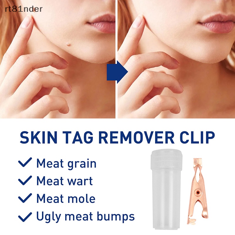 Rt 1 Dụng Cụ Kẹp Nhỏ Bằng Đồng Loại Bỏ Mụn Thịt / Hình Xăm