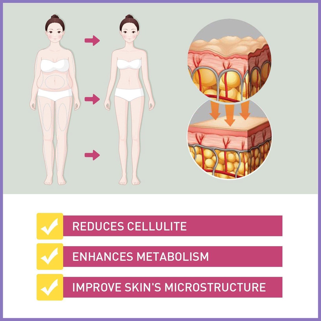 Viên Nang Giúp Đốt Cháy Mỡ Thừa Làm Săn Chắc Cơ Thể Cho Nữ nota2vn