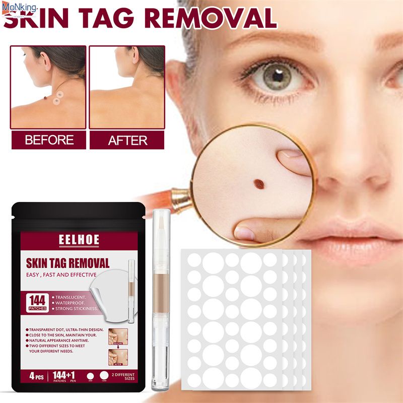 【Hiệu quả 100%】 Thuốc tẩy mụn cóc EELHOE Thuốc tẩy nốt ruồi chính hãng Bút loại bỏ thẻ da mà không để lại sẹo 144 miếng dán điều trị mụn cóc kèm bút tẩy nốt ruồi ^MK^