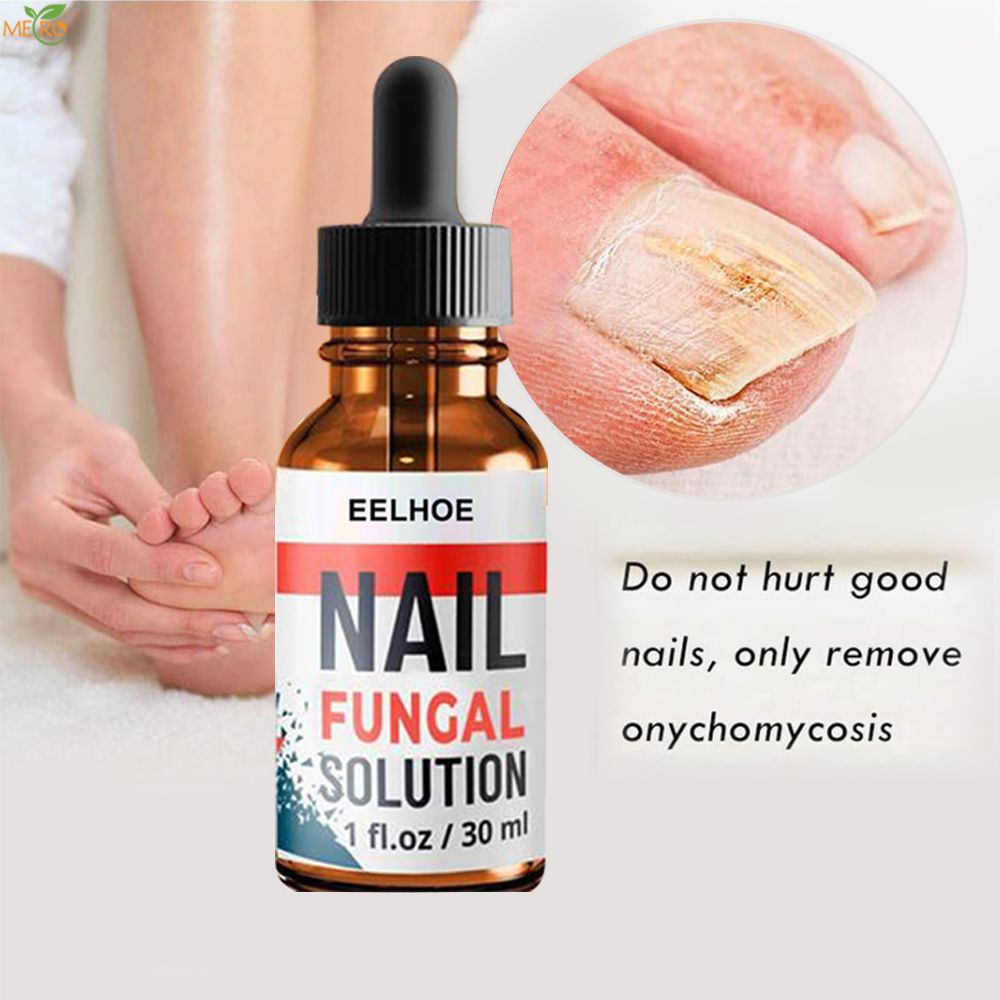 Eelhoe Tinh Chất Phục Hồi Móng Huyết Thanh Điều Trị Nấm Móng Loại Bỏ Nấm Móng Chân Tay Chân Chăm Sóc Da Metro
