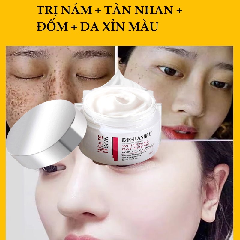 [Cam Kết Hết Nám, Sạm Da Trong 7 Ngày] Kem Hết Nám, Tàn Nhan Cao Cấp  Whitening Cream