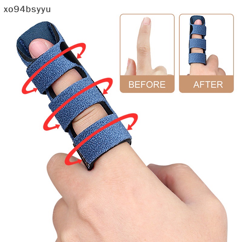 Nẹp Chỉnh Tư Thế Ngón Tay Xo94Bsyu Chuyên Dụng