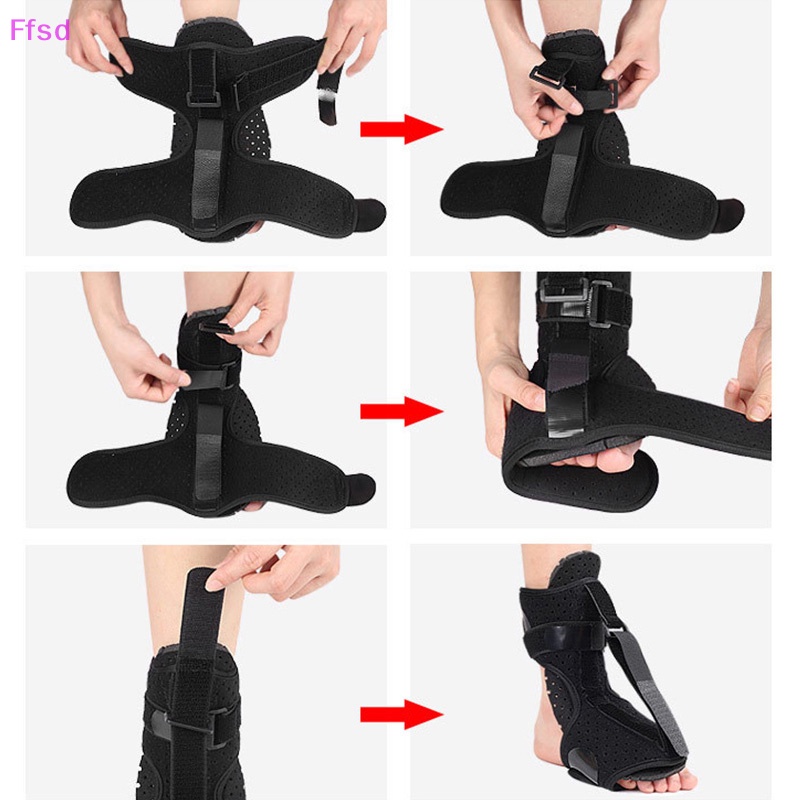 {Ffsd} Đai Nẹp Chỉnh Khớp Chân Vào Ban Đêm Hỗ Trợ Điều Chỉnh Đúng Tư Thế Chân