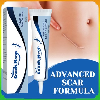 Gel trị sẹo kem xóa sẹo hiệu quả scar gel sẹo cũ trị sẹo trị sẹo mờ sẹo toàn cầu