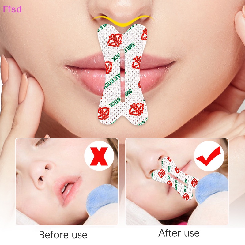 {Ffsd} Bộ 30 Miếng Dán Chống Ngáy Khi Ngủ / Môi / Mũi Cảm Giác Thông Thoáng * Bán Chạy