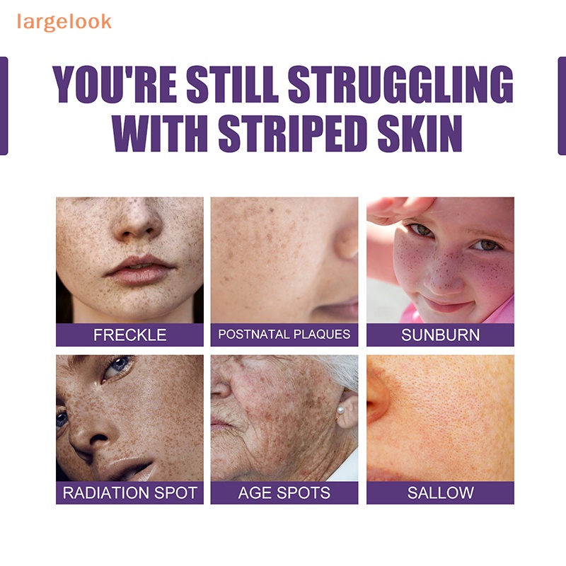 Cây Lăn Loại Bỏ Đốm Đen Làm Sáng Da Mặt 10ml