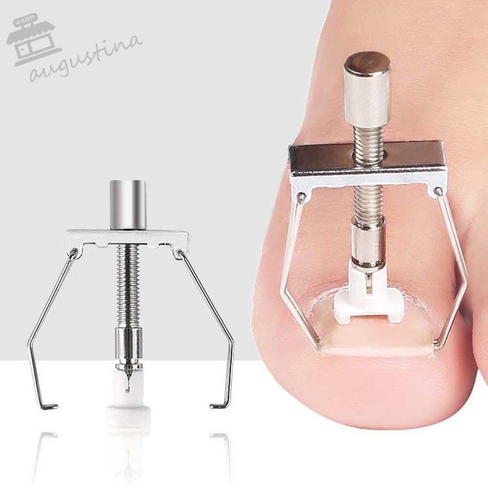 Dụng Cụ Định Hình Móng Chân Mọc Ngược AUGUSTINA Bằng Thép Không Gỉ