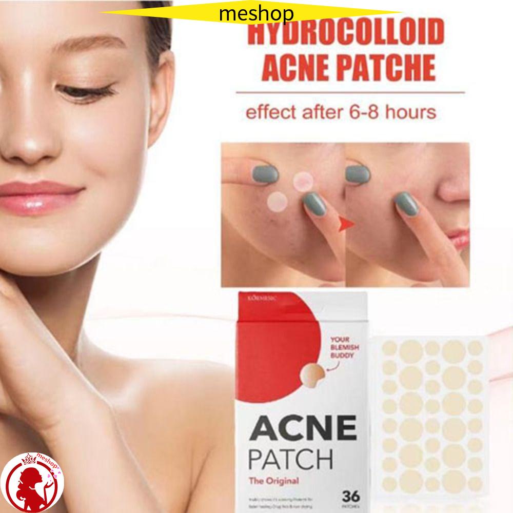 Miếng Dán Mụn Hydrocolloid Hấp Thụ Nhanh
