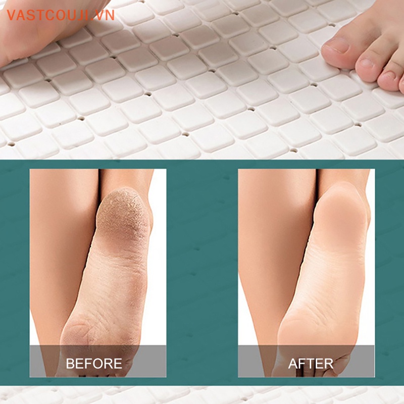 Dụng Cụ Dũa Tẩy Tế Bào Chết Cho Bàn Chân Hai Mặt VASTJI