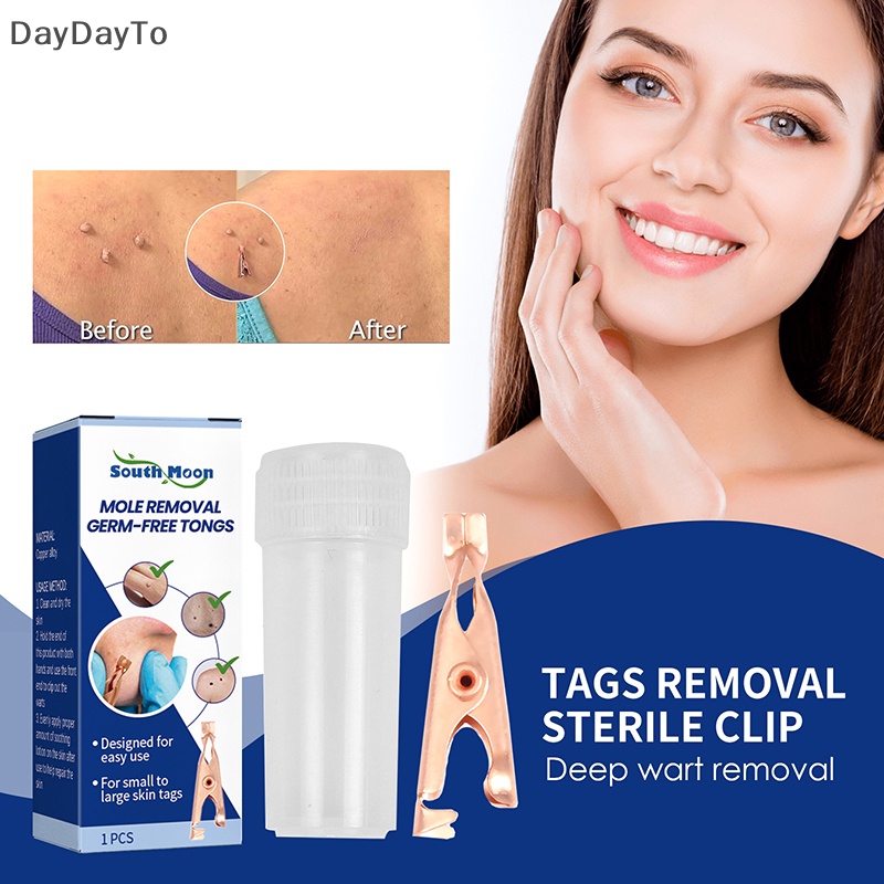 1 Dụng Cụ Kẹp Nhỏ Bằng Đồng Loại Bỏ Mụn Cóc Hình Xăm