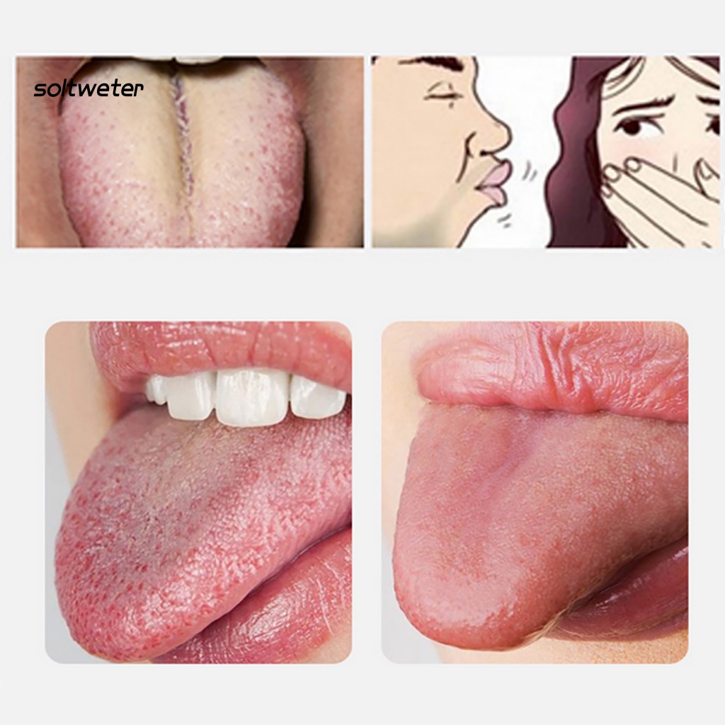 Dụng Cụ Vệ Sinh Lưỡi Cứng Gọn Nhẹ Bề Mặt Mịn Màng Mạnh Mẽ Dùng Làm Quà