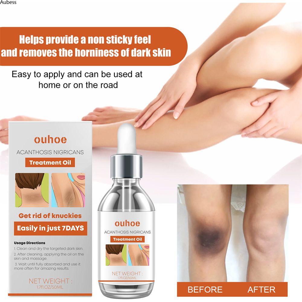 Ouhoe Serum Kiểm Soát Dầu Nghệ Làm Trắng Sáng Da Trị Thâm Nám Dầu Mát Xa Làm Trắng Vùng Nách 50Ml AubessDS
