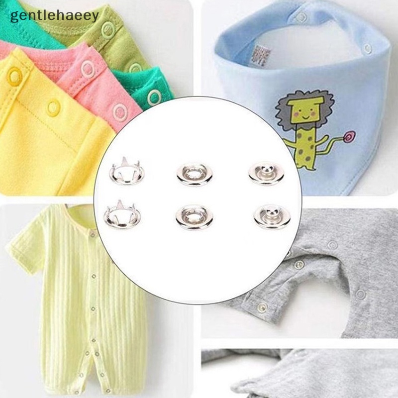 Bộ 100 Kẹp Kim Loại Chuyên Dụng Cho May Vá