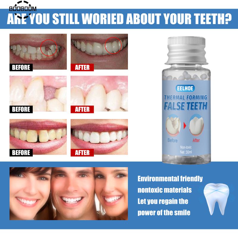 30g Dental filling Temporary Teeth Repair Kit Dental Decorative Denture Replace Missing Denture Tooth Replacement Material booboom