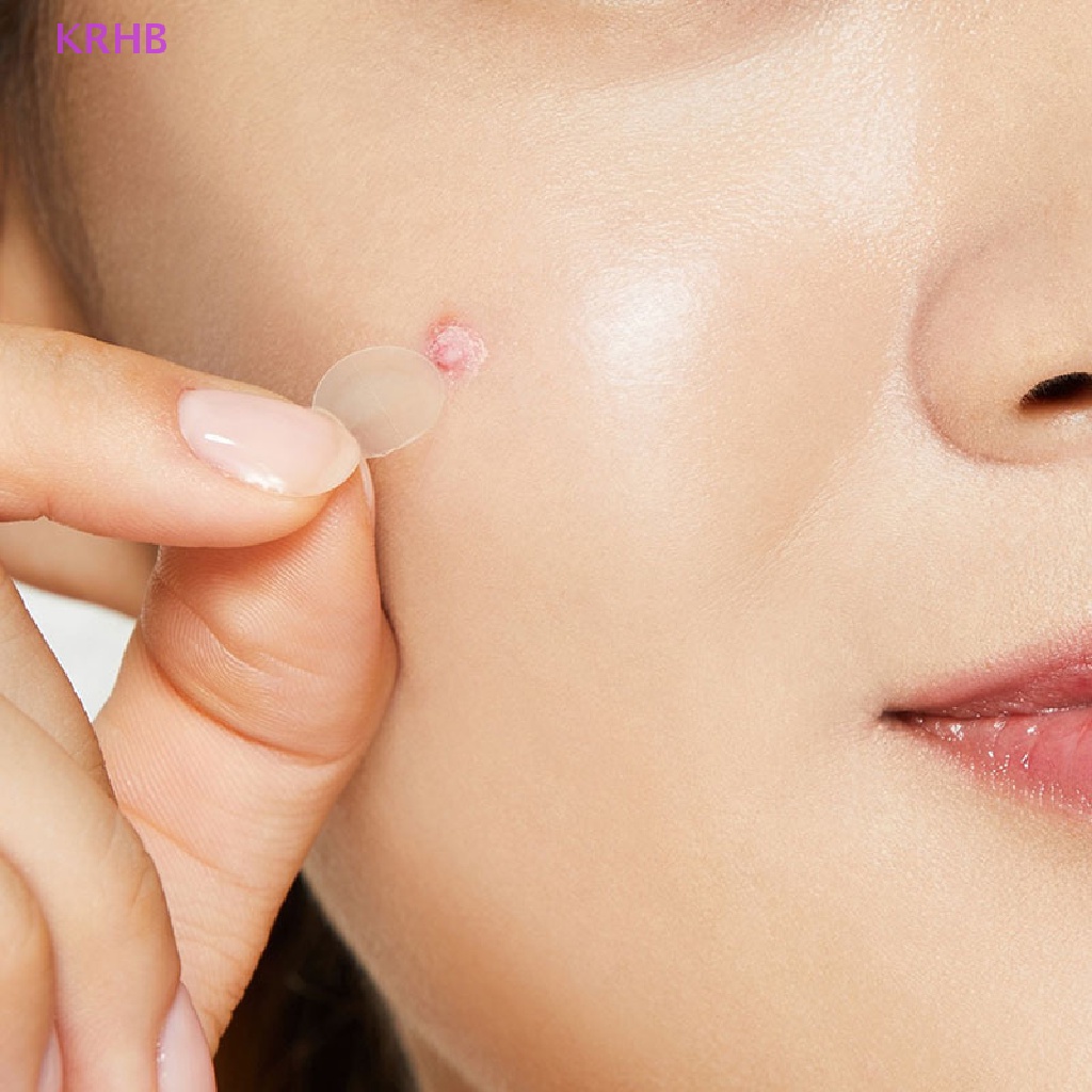 Set 72 Miếng Dán Hỗ trợ giảm mụn KRHB Cao Cấp Chuyên Dụng