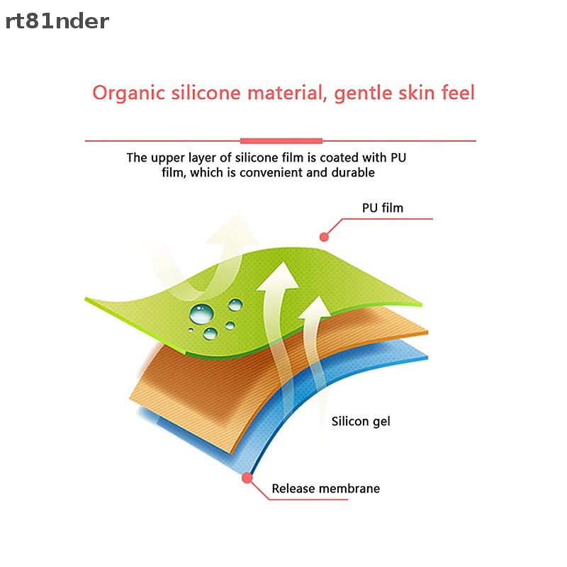 Đai Đeo Điều Chỉnh Tư Thế Tai Cho Bé Sơ Sinh