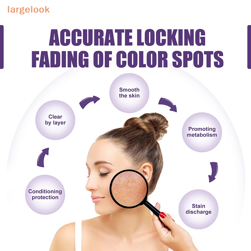 Cây Lăn Loại Bỏ Đốm Đen Làm Sáng Da Mặt 10ml