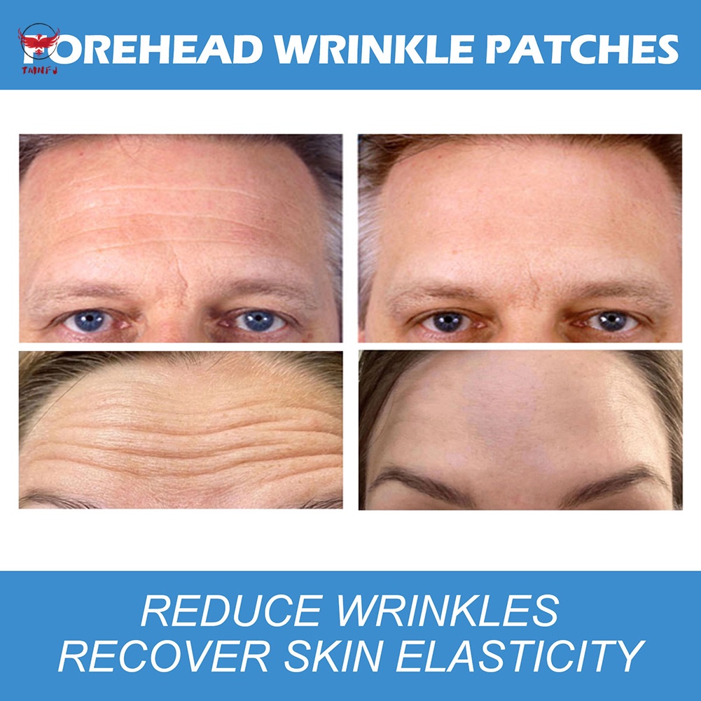 Miếng Dán Làm Săn Chắc Da Chống Nếp Nhăn Cho Vùng Trán