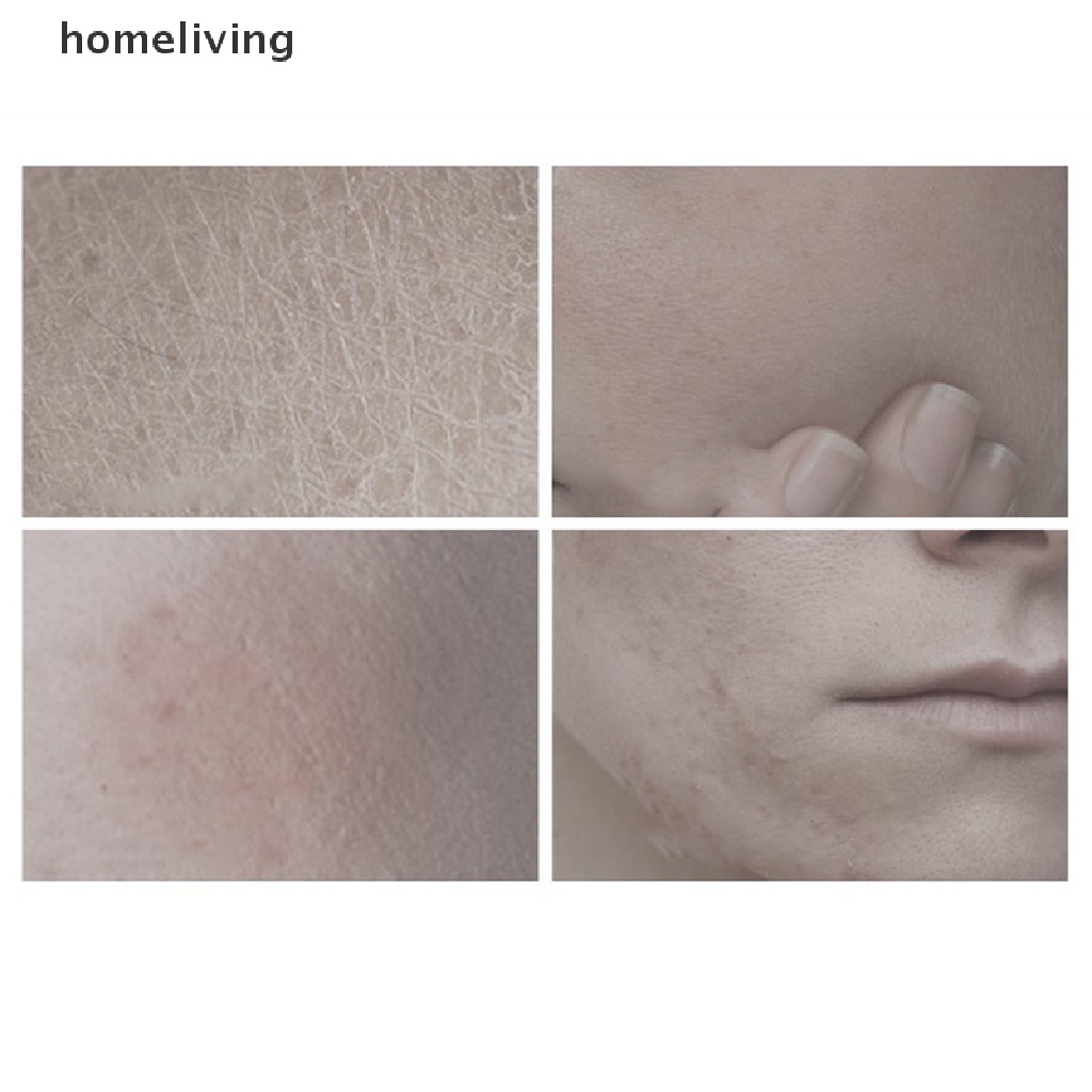 Bộ 20 Mặt Nạ Collagen Dưỡng Ẩm Se Khít Lỗ Chân Lông Chống Lão Hóa