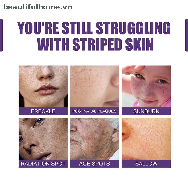 Thanh Lăn Loại Bỏ Đốm Đen Làm Sáng Da Mặt 10ml