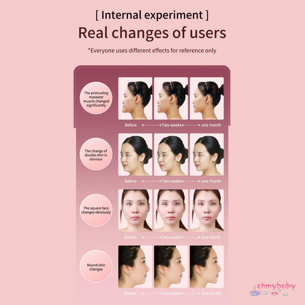 [OMB] Máy Nâng Cơ Mặt Led Liệu Pháp Photon Rung Mát Xa Giảm Béo Hình Chữ V Đôi Cằm Má Thiết Bị [Z/14]