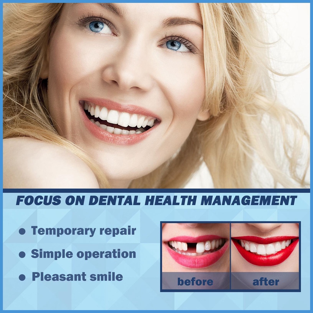 Bộ Dụng Cụ Sửa Chữa Răng Giả Tạm Thời Có Thể Gập Lại Để Sửa Chữa Đường Nứt Và Gãy Răng