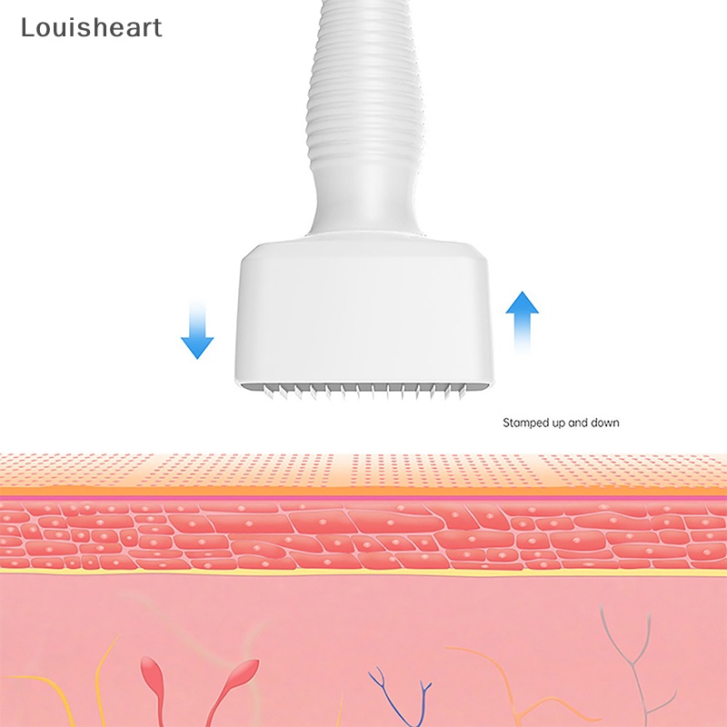 Louisheart 140a có thể điều chỉnh chiều dài vi mô 0 ~ 3mm s derma stamp để điều trị chăm sóc da mặt nếp nhăn cải thiện hyaluronic tfg