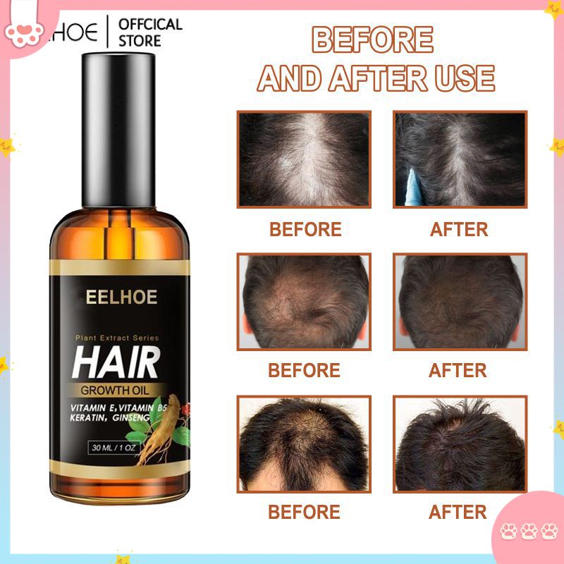 EELHOE Serum Moroccan Mọc Tóc Chống Rụng Tóc Ngăn Ngừa Hói Đầu Điều Trị Sửa Chữa Da Đầu Khô Hư Tổn Đường Chân Tóc Tiết Bã Hướng Lên Trên Để Chăm Sóc Sắc Đẹp Cho Tóc