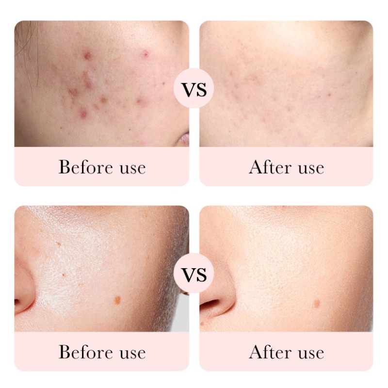 Toner Nước Hoa Hồng BIOAOUA Hoa Hồng Hyaluronic Acid Thu Nhỏ Lỗ Chân Lông 100ml