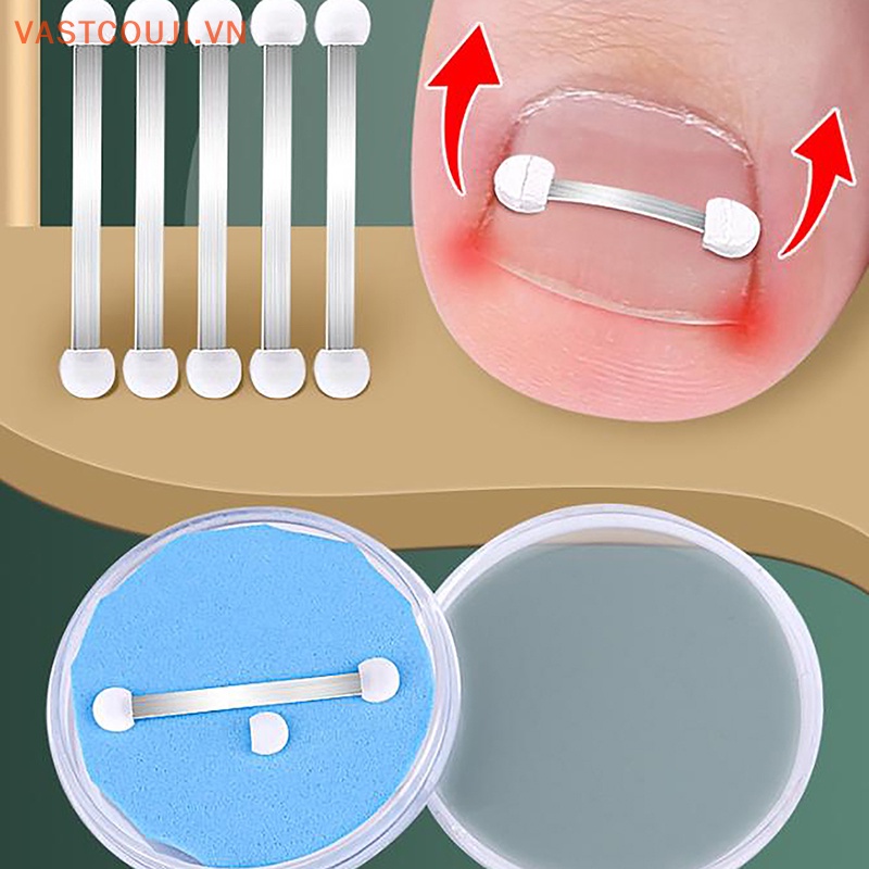 Kẹp Co Giãn Chỉnh Sửa Móng Chân Bị Cong Vnstji