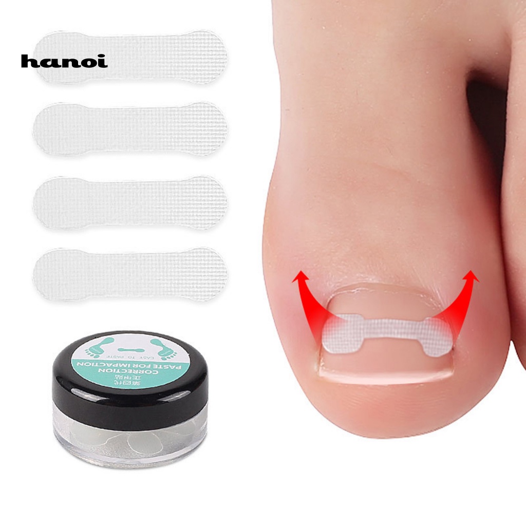 Hộp 10 Miếng Dán Chỉnh Sửa Móng Chân Nhanh Chóng Tiện Lợi