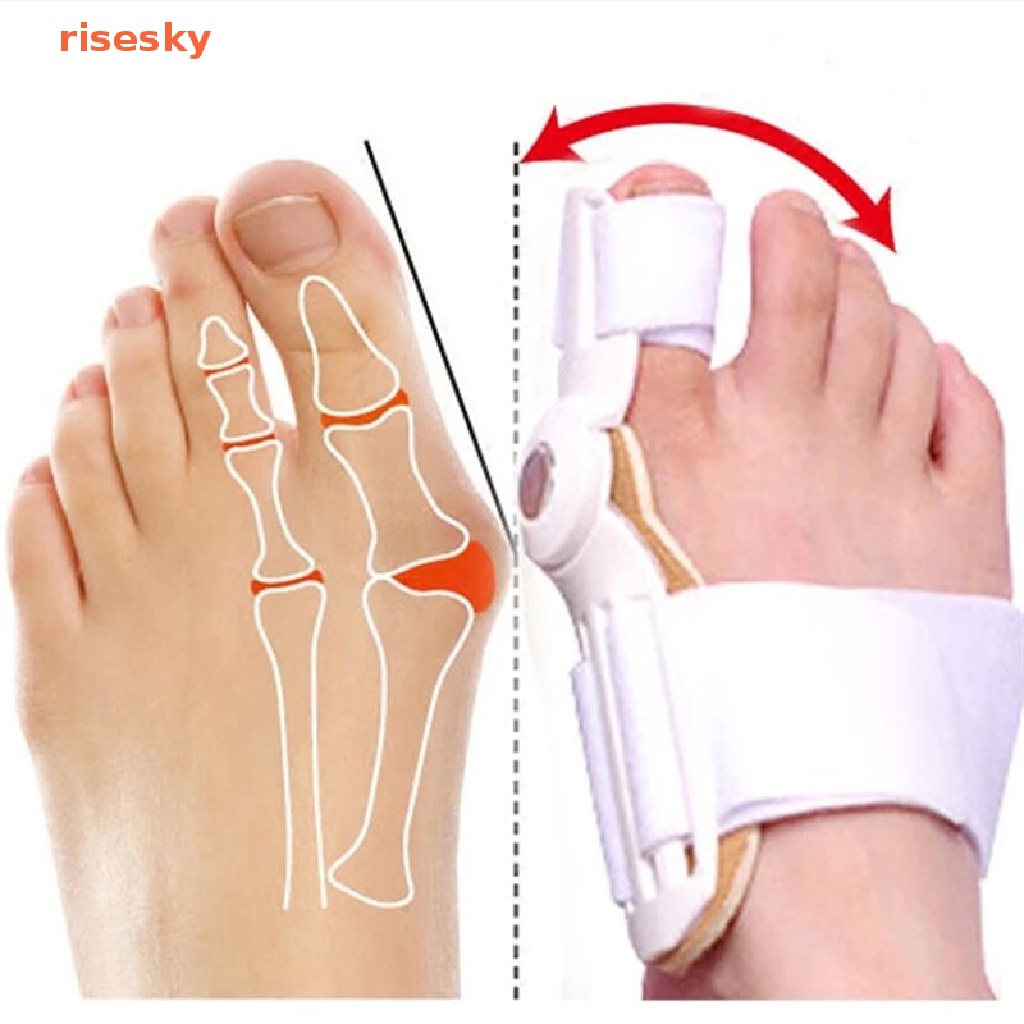 Nẹp Nẹp Điều Chỉnh Ngón Chân Giảm Đau Chỉnh Tư Thế Vẹo