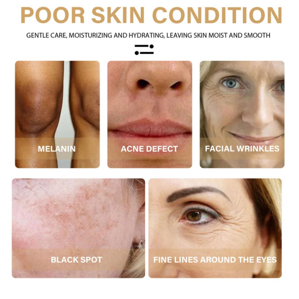 Tinh Chất Phục Hồi Da Chống Nếp Nhăn Làm Mờ Vết Thâm OUHOE T8M7