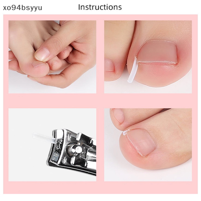 Set 10 Miếng Dán Chỉnh Sửa Móng Chân Xo94Bsyu