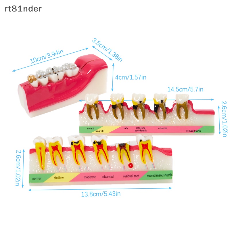 Mô Hình Hàm Răng Thí Nghiệm Chất Liệu rt Chất Lượng Cao