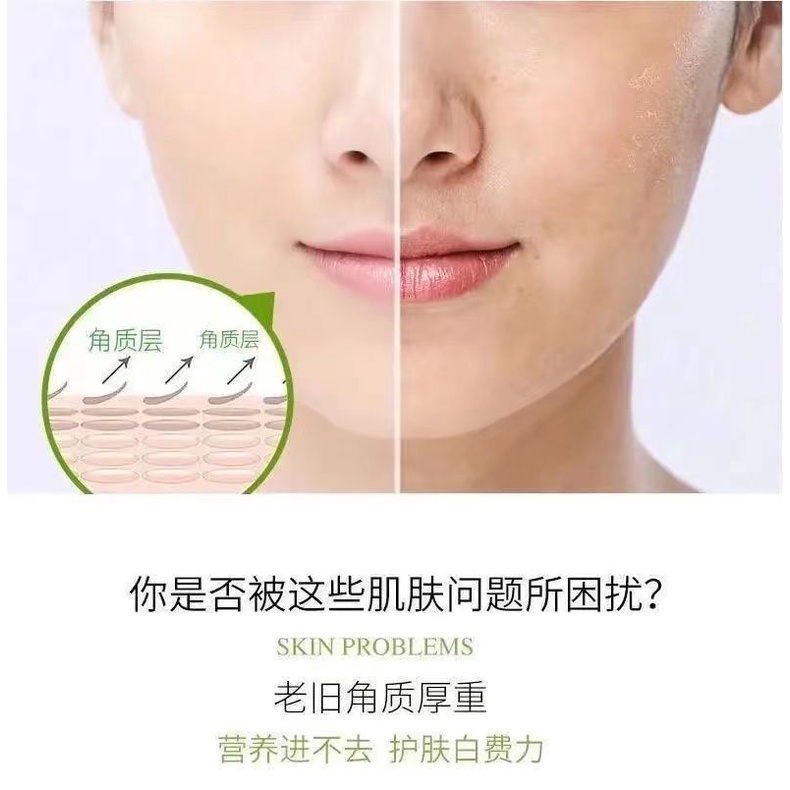 Gel Tẩy Tế Bào Chết Chiết Xuất Lô Hội Yinmei Làm Sạch Sâu Tẩy Tế Bào Chết Và Không Gây Kích Ứng Chăm Sóc Da