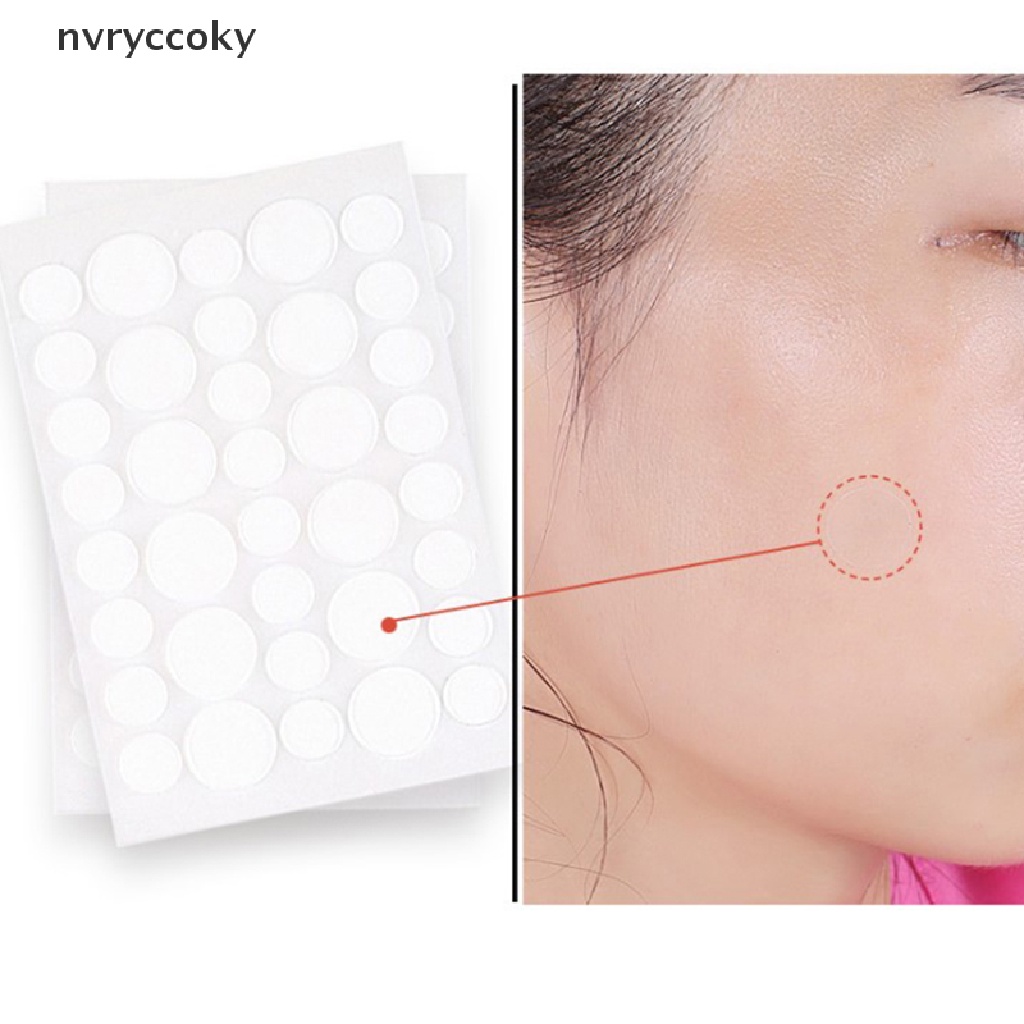 Miếng Dán Lột Mụn Trứng Cá Hấp Thụ Dầu Và Mụn Trứng Cá