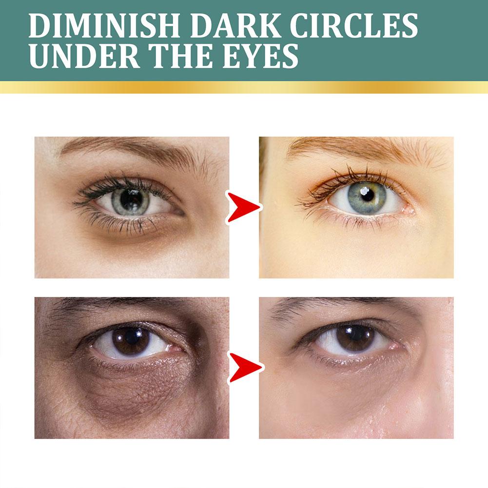 Kem Mắt EELHOE 100ml X5W6 Chống Lão Hóa Giảm Quầng Thâm Làm Săn Chắc Da