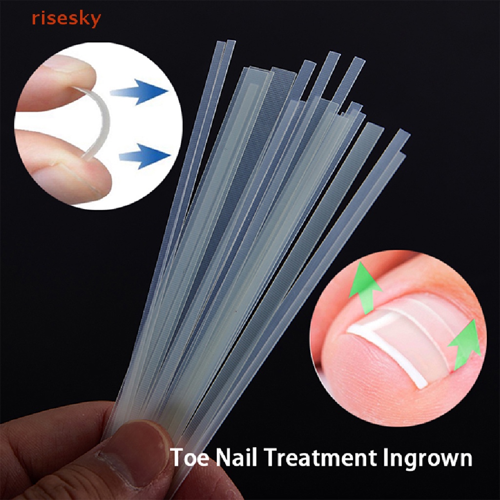 Set 5 Miếng Dán Chỉnh Sửa Móng Chân Mọc Ngược Tiện Lợi