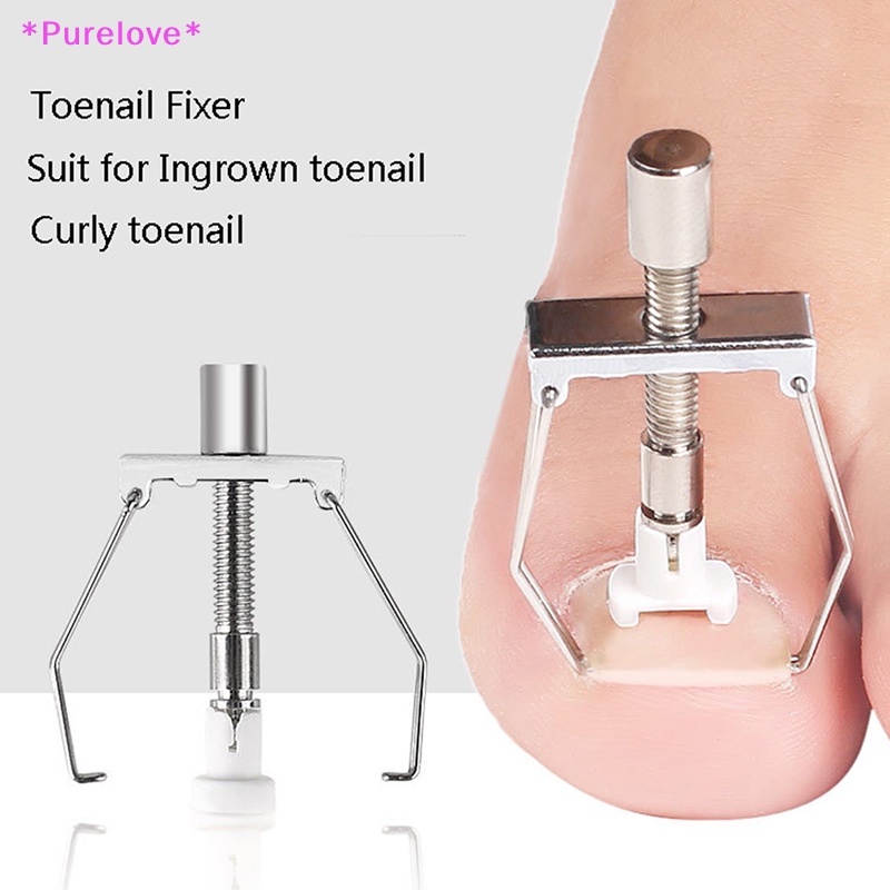 Dụng Cụ Định Hình Móng Chân Mọc Ngược Tiện Dụng Mới