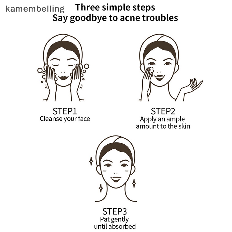 1 Tuýp Kem Hỗ Trợ Giảm Mụn Thảo Dược kamembelling