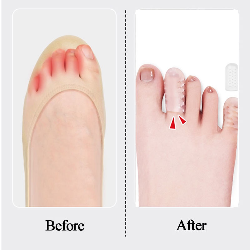 Đệm Silicone Bảo Vệ Ngón Chân Chống Thấm Nước Thoáng Khí Cỡ Lớn Và Nhỏ