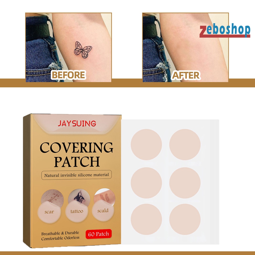 Hộp 60 Miếng Dán Sẹo Mụn Bằng Vải Không Dệt Chống Nước An Toàn