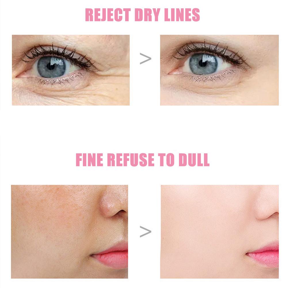 Thỏi Kem Làm Săn Chắc Da Mắt Chống Nếp Nhăn X0V8