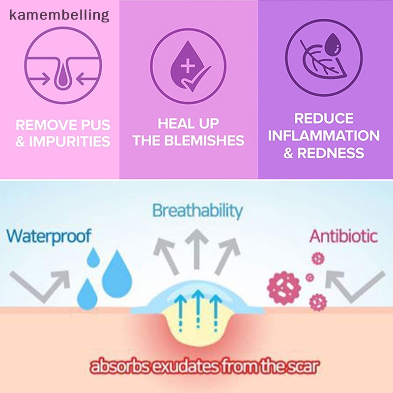 Bộ 90 Miếng Dán Loại Bỏ Mụn Trứng Cá kamembelling